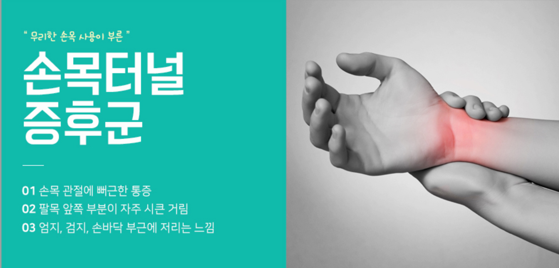 손목터널증후군